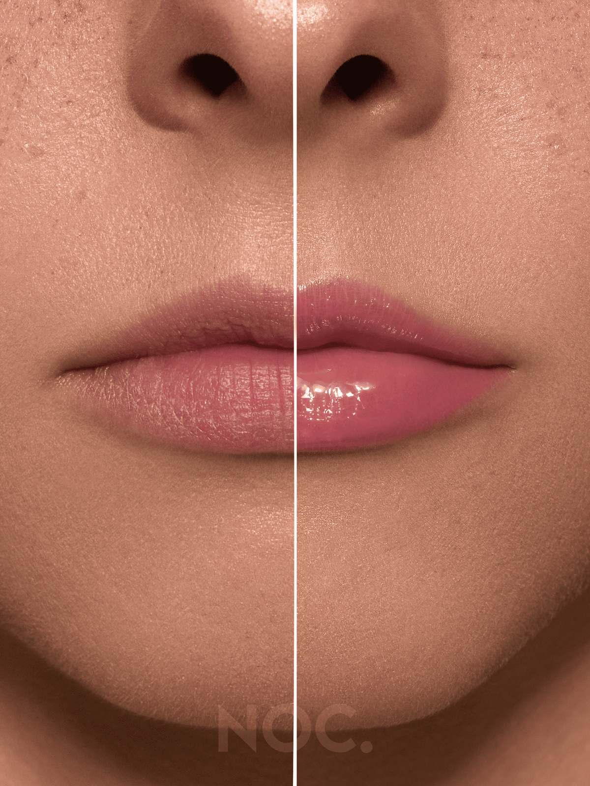 Vorher-Nachher: Lippen ohne und mit Lust Garden Lip Butter in zartem Rosé, getönter Lippenbalsam mit Peptiden
